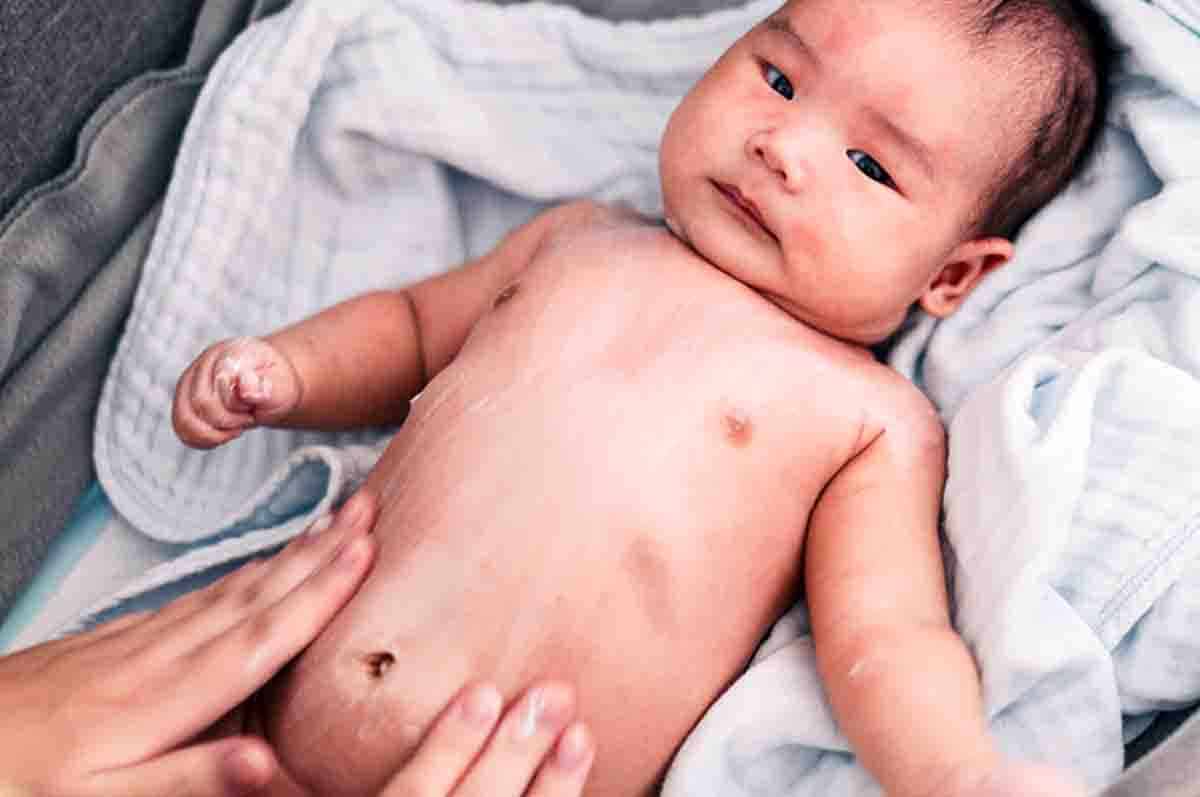 Jaringan Usus Tidak Berfungsi Ciri ciri usus melintir pada bayi yang sangat kronis