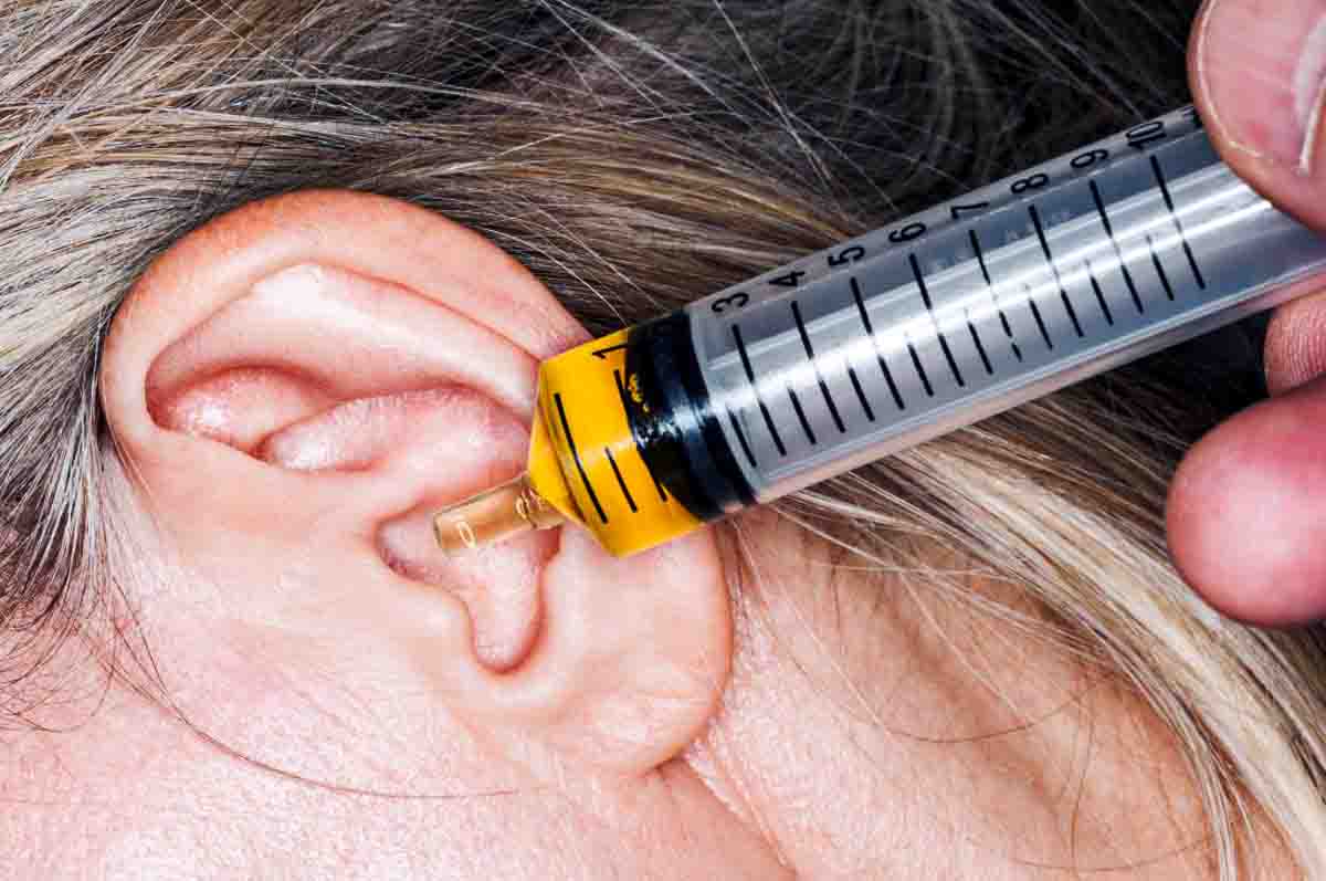 Bisa Menggunakan Syringe - Cara Membersihkan Telinga yang Tersumbat  Kotoran