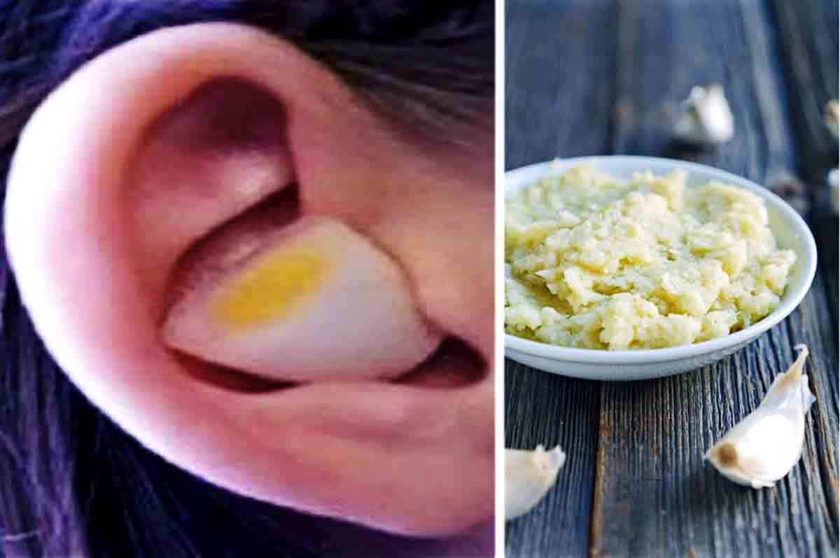 Menggunakan Bawang Putih - Cara Membersihkan Telinga yang Kotor