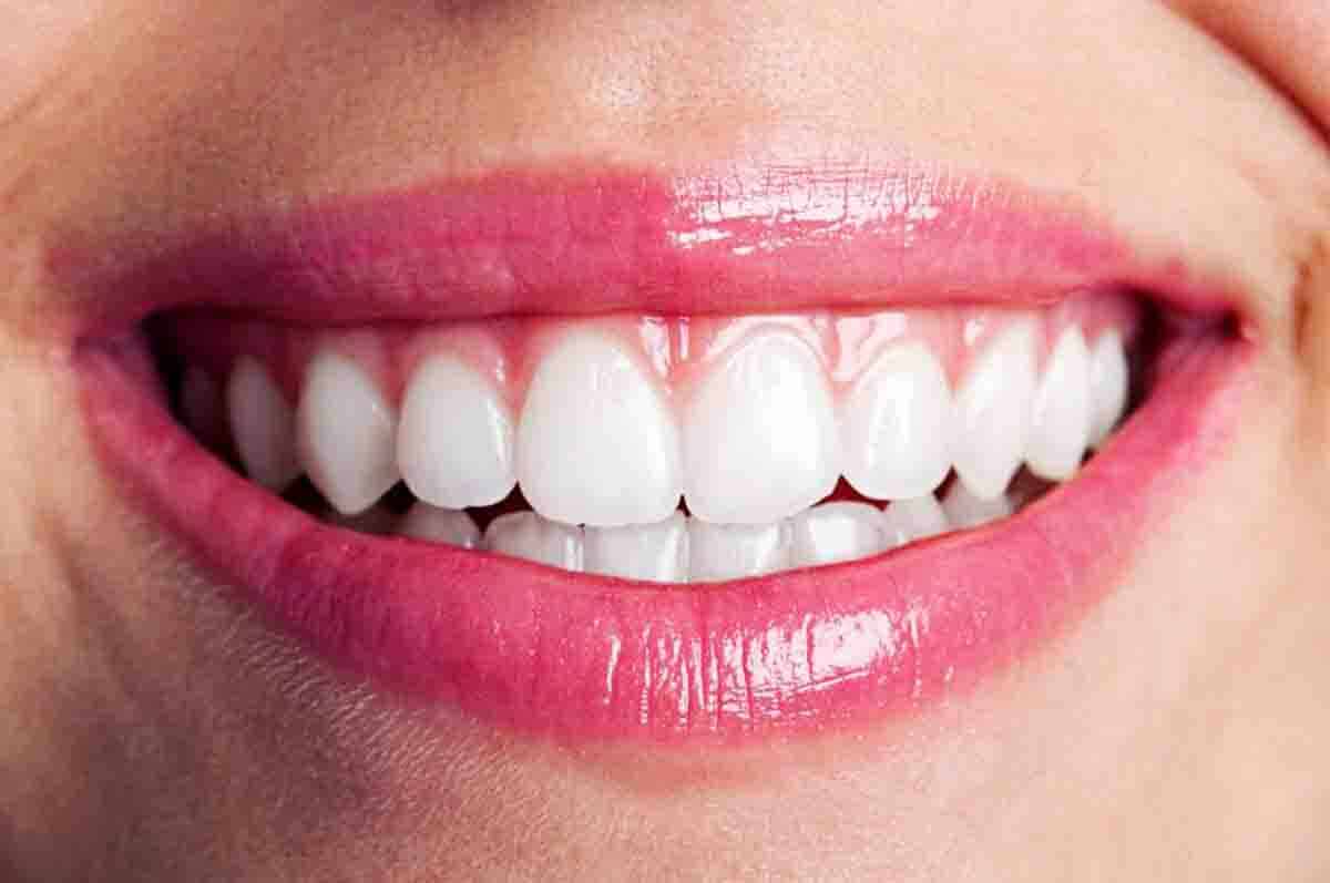 Gigi Seri Rahang Atas - Fakta tentang berapa jumlah gigi orang dewasa yang di depan dan atas