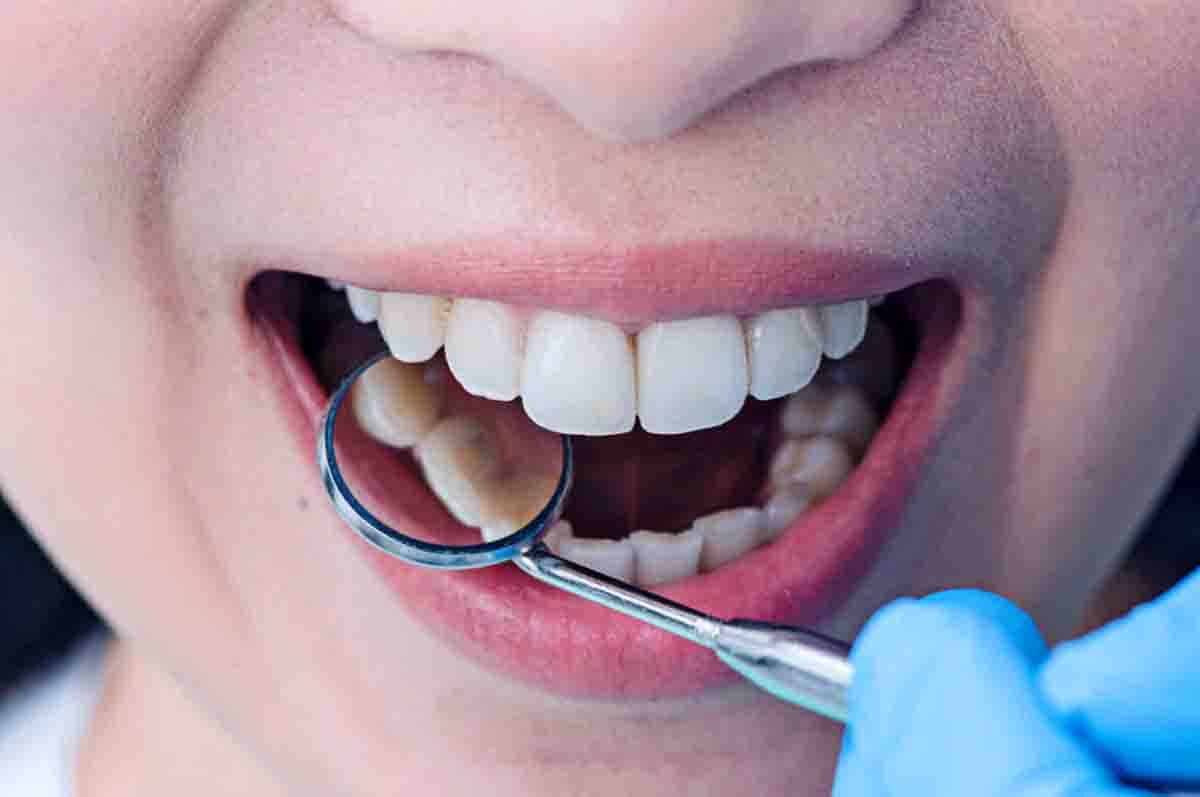 Gigi Geraham Rahang Atas - Fakta tentang berapa jumlah gigi orang dewasa yang berfungsi melumat makanan