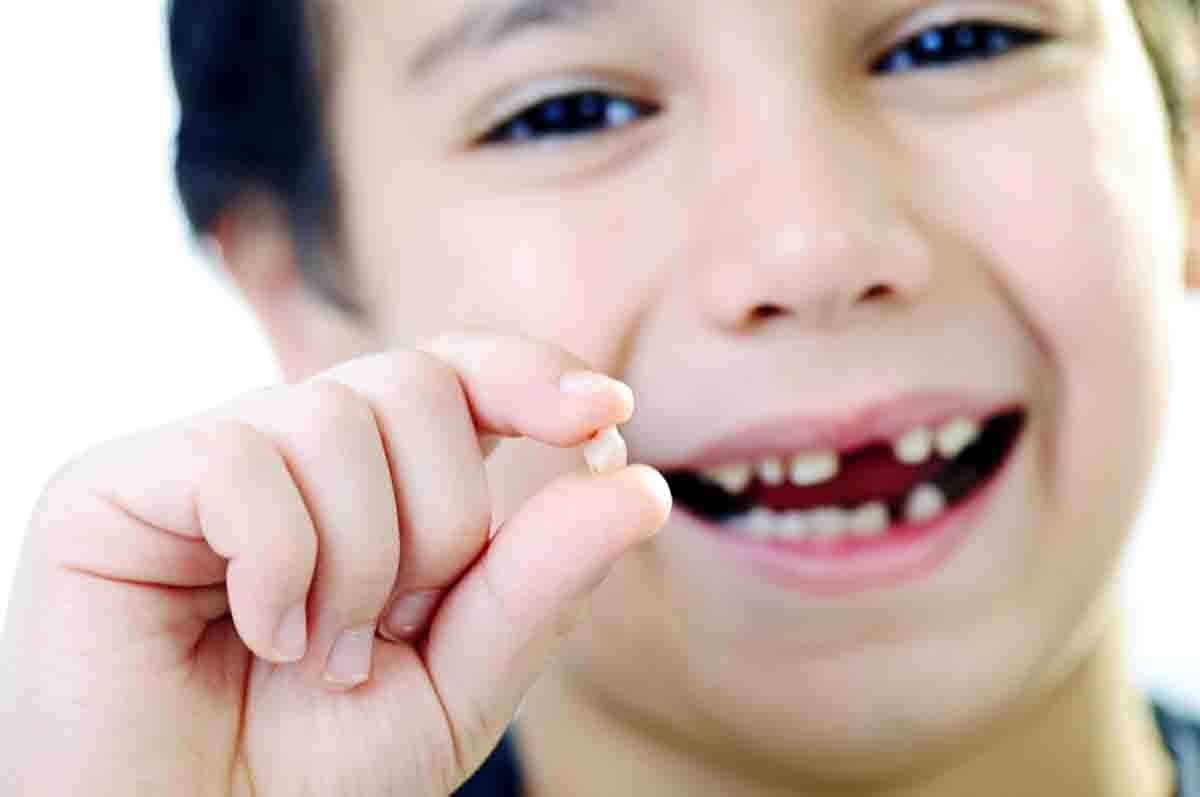 Gigi Susu dan Gigi Permanen - Fakta tentang gigi susu lepas umur berapa dan perbedaan akar keduanya