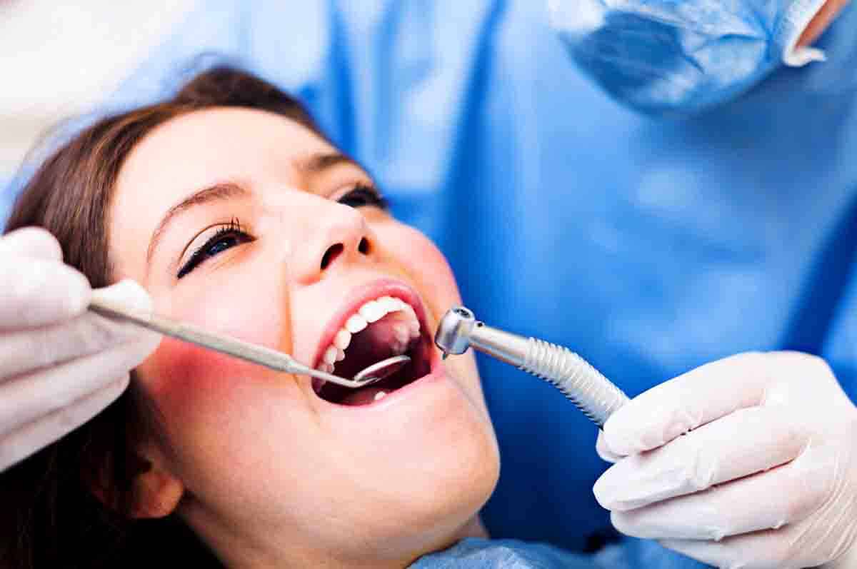 Gigi Geraham Bungsu Rahang Atas dan Bawah - Fakta tentang berapa banyak gigi orang dewasa yang biasanya muncul paling akhir