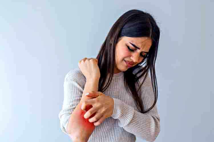 Alergi dan Gatal - Efek Samping Merica dapat menimbulkan alergi dan gatal