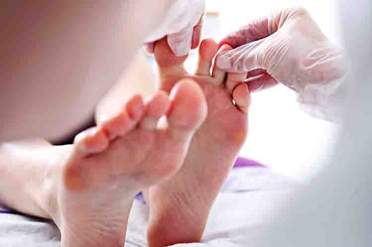 Perubahan Pada Kulit Atau Kuku Kaki - Ciri-ciri penyakit gula pada kaki terletak pada perubahan pada kulit atau kuku kaki