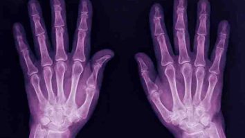 Menggerakkan Pangkal Jari - Tulang jari-jari tangan disebut phalanges yang fungsinya adalah untuk menggerakkan pangkal jari