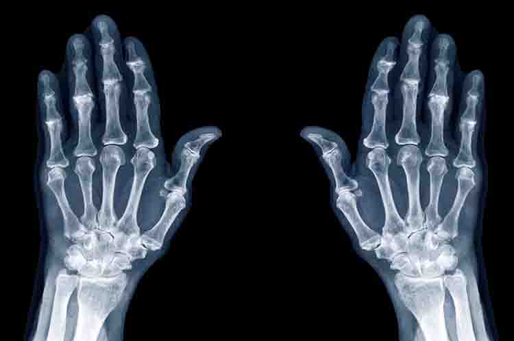 Sebagai Tempat Melekatkan Ligamen - Tulang jari-jari tangan disebut phalanges yang fungsinya adalah sebagai tempat melekatkan ligamen