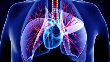 Ukuran Kedua Paru-Paru Tidak Sama Besar - Berapa volume udara residu yang terdapat dalam paru-paru yang diketahui dapat mengakibatkan ukuran kedua paru-paru tidak sama besar