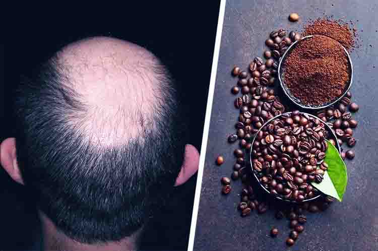Mengembalikan Pertumbuhan Rambut - Manfaat keramas dengan kopi adalah untuk  mengembalikan pertumbuhan rambut